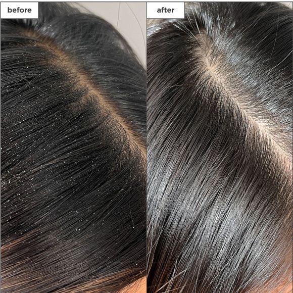 BRIOGEO Scalp Revival™ Charcoal + Tea Tree Buildup Detox Spray NWT - Picture 2 of 5